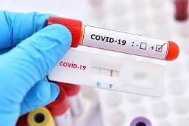 Tăng cường các biện pháp quản lý đối với việc mua, bán TEST xét nghiệm và thuốc điều trị Covid-19